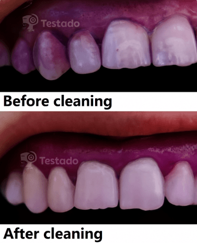 Before and after cleaning